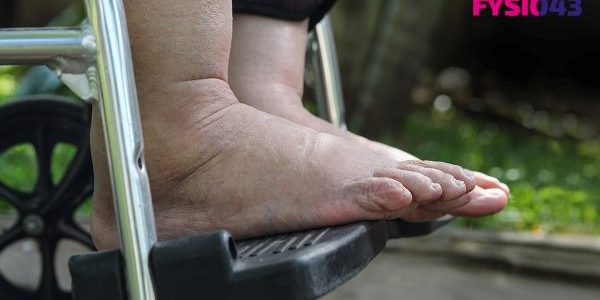 Oedeemtherapie Ingezoomde foto van twee voeten waarbij iemand oedeemtherapie heeft en in een rolstoel zit